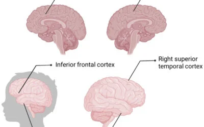 The impact of child poverty on brain development: does money matter?